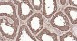 RPS19 Recombinant Rabbit mAb